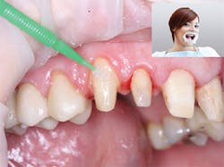 P1411dechr02 P1411dechr02