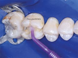 P1411dechr03 P1411dechr03