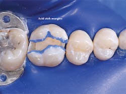 P1411dechr05 P1411dechr05