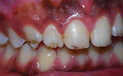 P1411dewei01 P1411dewei01