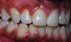 P1411dewei03 P1411dewei03