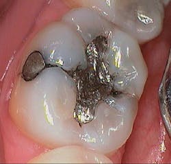 P1411dewei04 P1411dewei04