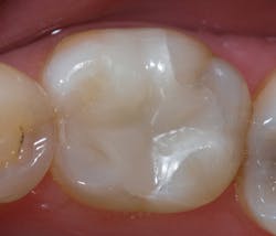 P1411dewei07 P1411dewei07