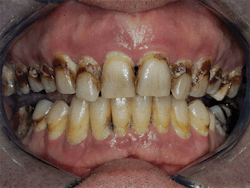 P1412dechr01 P1412dechr01