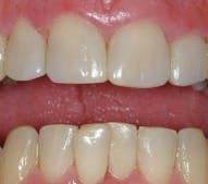 Pennwell web 191 170 Pennwell web 191 170