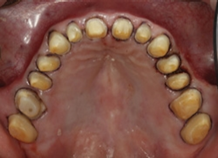 Is Cord Still King Dental Economics Is Cord Still King Dental Economics