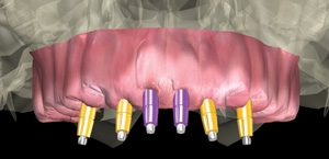 Pennwell web 300 145