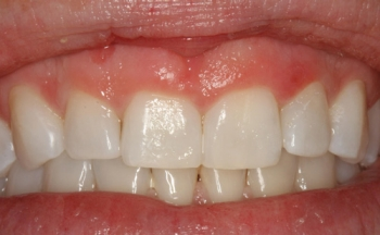 Pennwell web 350 216