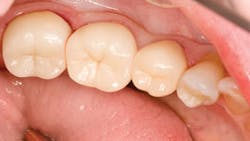 Poss Dr Stephen De April 2014 Feature Fig 4 All Ceramic Restorations Seated1 Poss Dr Stephen De April 2014 Feature Fig 4 All Ceramic Restorations Seated1