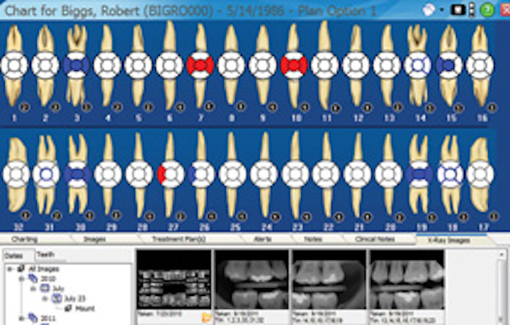 Ramey Charting Screen
