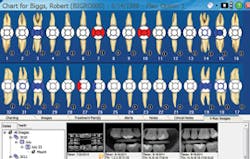 Ramey Charting Screen Ramey Charting Screen