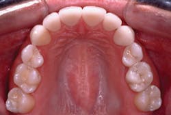 Ses Accd Dr Michael Sesemann De Feb 2014 Figure 2new Ses Accd Dr Michael Sesemann De Feb 2014 Figure 2new