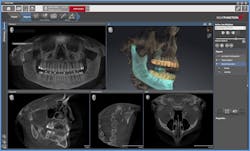Sicat Figure 3 Sicat Figure 3