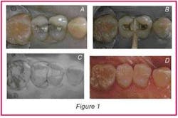 Th 0510deri Fig1 Th 0510deri Fig1