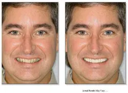 Th 0511degol02 Th 0511degol02