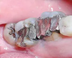 Th 0511degol04 Th 0511degol04