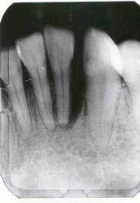 Th 0607dekel1 Th 0607dekel1