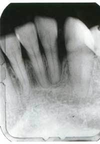 Th 0607dekel2 Th 0607dekel2