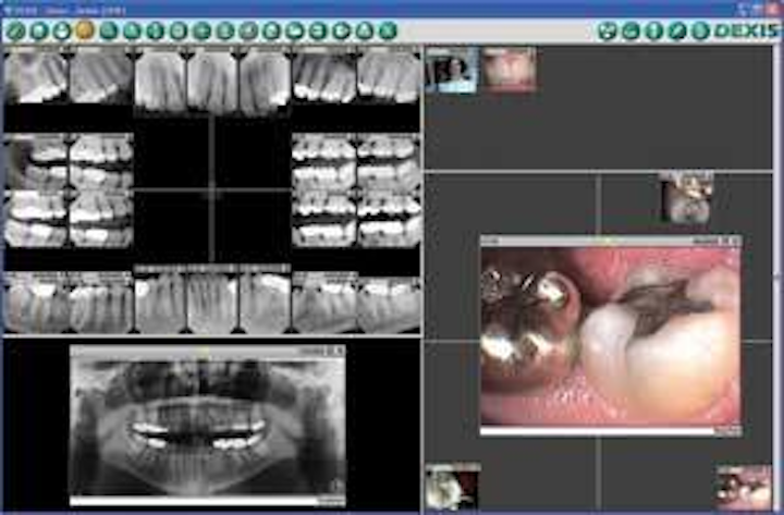 Th 0609decyn01