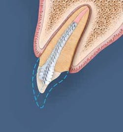 Th 0609depea03 Th 0609depea03