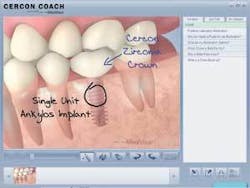 Th 0609depea04 Th 0609depea04