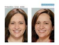 Th 0609dewei02 Th 0609dewei02