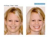 Th 0609dewei03 Th 0609dewei03