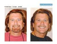 Th 0609dewei04 Th 0609dewei04