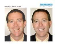 Th 0609dewei05 Th 0609dewei05