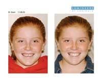 Th 0609dewei06 Th 0609dewei06