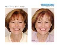 Th 0609dewei07 Th 0609dewei07