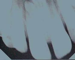 Th 0611demar01 Th 0611demar01