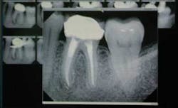 Th 0611demar03 Th 0611demar03