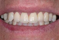 Th 0611demet02 Th 0611demet02