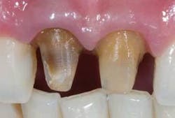 Th 0611demet05 Th 0611demet05