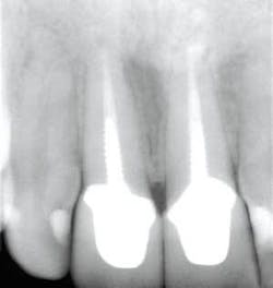 Th 0611demet06 Th 0611demet06