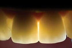 Th 0611demet07 Th 0611demet07