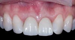 Th 0611demet08 Th 0611demet08