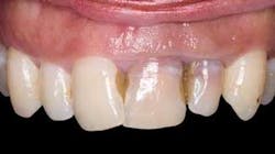 Th 0611demet09 Th 0611demet09