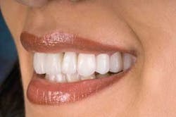 Th 0611demet11 Th 0611demet11