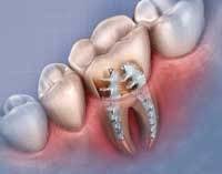 Th 0612detopten10 Th 0612detopten10