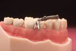 Th 0701depea01 Th 0701depea01