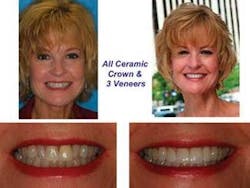 Th 0701derad01 Th 0701derad01