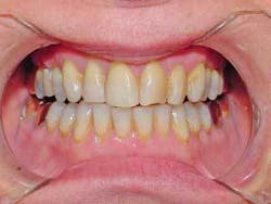 Th 0702desil01 Th 0702desil01