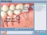 Th 0702detop11 Th 0702detop11