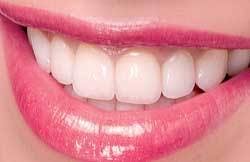 Th 0702detop12 Th 0702detop12