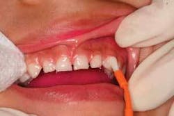 Th 0702detop15 Th 0702detop15