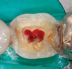 Th 0703degri05 Th 0703degri05