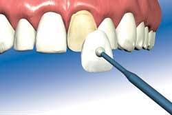 Th 0703depea03 Th 0703depea03