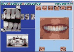 Th 0705deexc01 Th 0705deexc01